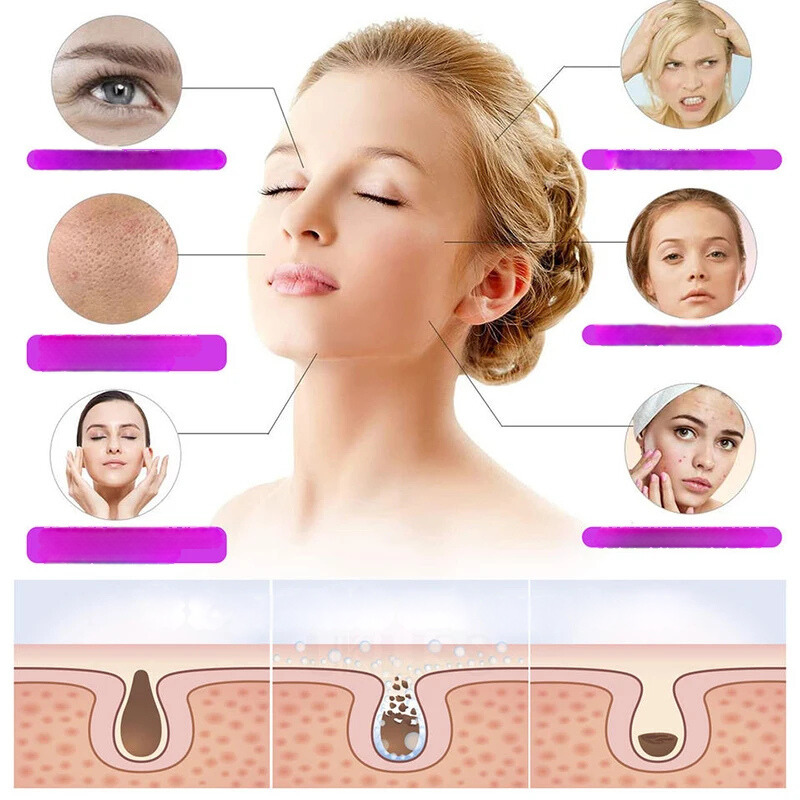 Lumithera - High Frequency Skin and Eye Care Magic Wand met ozontechnologie-2