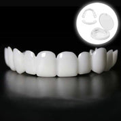 Direct een stralende glimlach met Snap on Smile Veneers 0