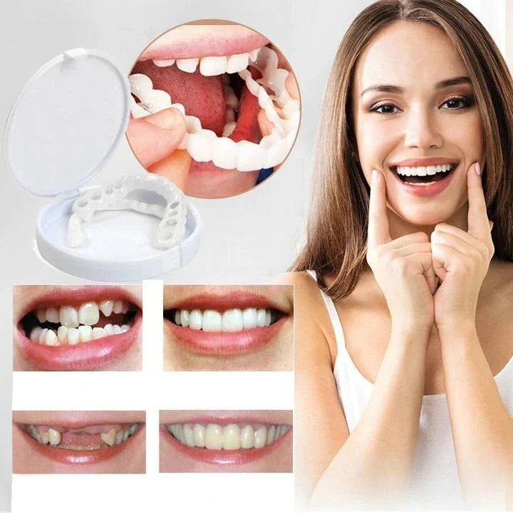 Direct een stralende glimlach met Snap on Smile Veneers 1