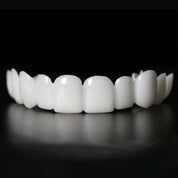 Direct een stralende glimlach met Snap on Smile Veneers 2