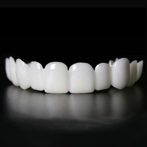 Direct een stralende glimlach met Snap on Smile Veneers 2