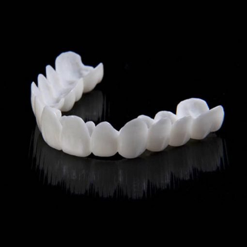 Direct een stralende glimlach met Snap on Smile Veneers 3