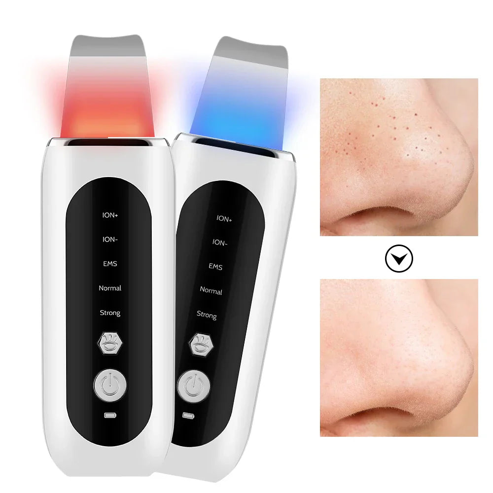 Radiantglow - Face Porne Cleaner en Blackhead Remover-1