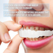 Smile Veneer (inclusief boven- en onderzijde) 3