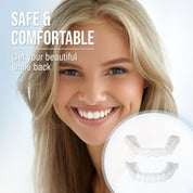 Smile Veneer (inclusief boven- en onderzijde) 4