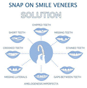 Smile Veneer (inclusief boven- en onderzijde) 5