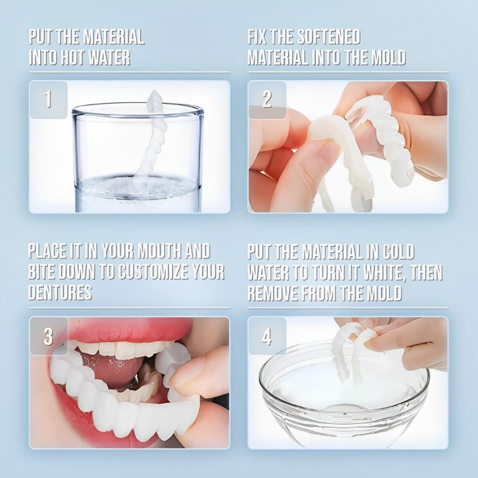 Smile Veneer (inclusief boven- en onderzijde) 6