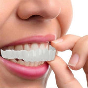 Smile Veneer (inclusief boven- en onderzijde) 7